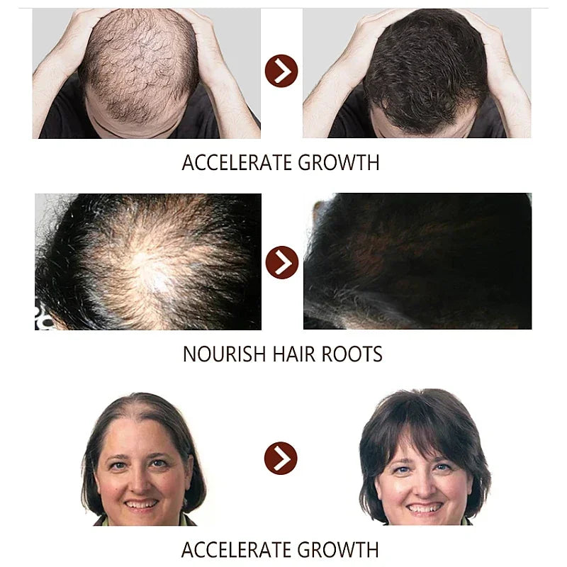 Fast Hair Growth Ginger Growth Hair Oil Treatment Anti Hair Loss Men Women Scalp Treatment