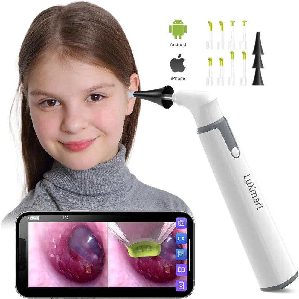 Ear Camera Endoscope 3.9mm Wireless Otoscope 720P HD WiFi Ear Scope with 6 LED for Kids and Adults Support Android and iPhone